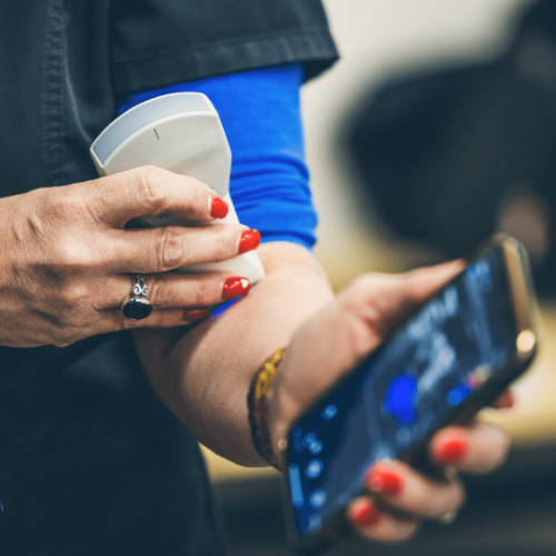 handheld ultrasound